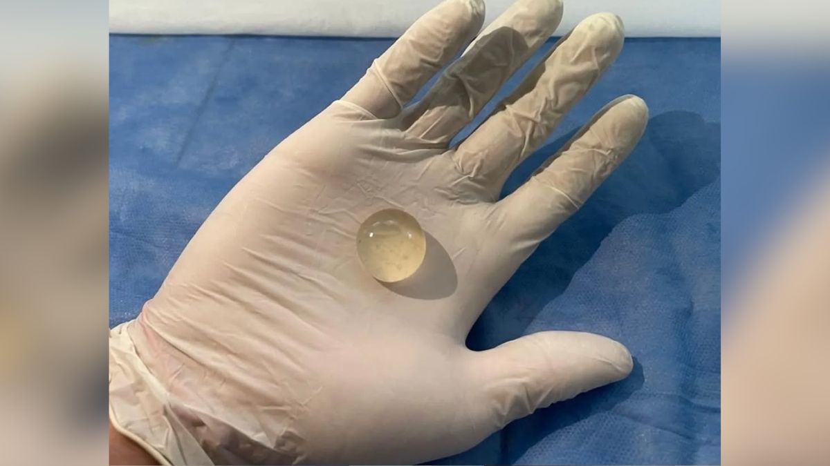 Según explicó Barletta