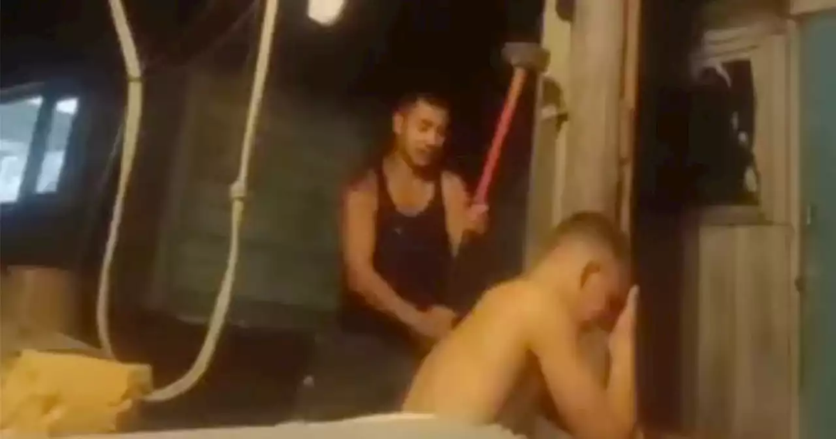 Un conscripto ruso se quebró el brazo con un martillo para no ir a la guerra.