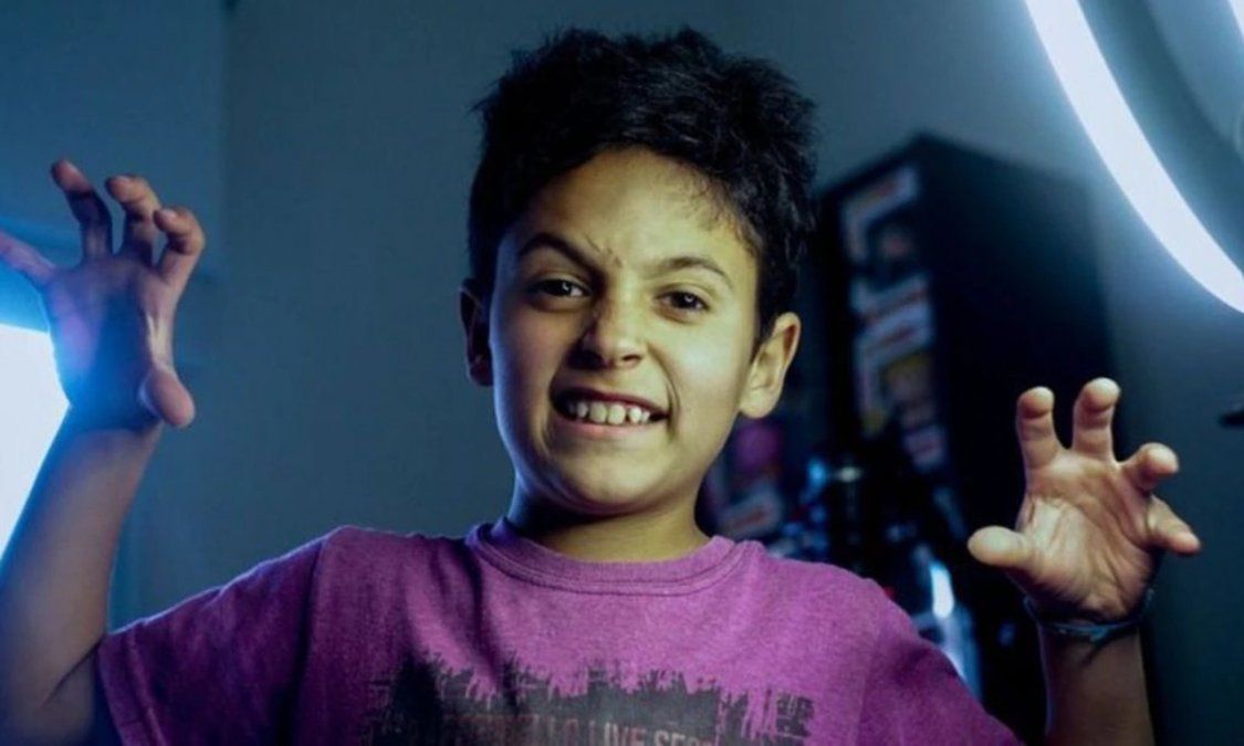 “Pensaba que era normal el audio