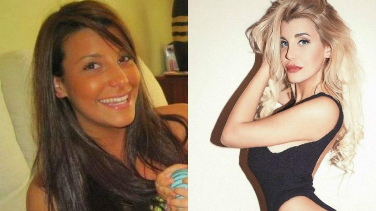 El Impactante Antes Y Despues De Charlotte Caniggia