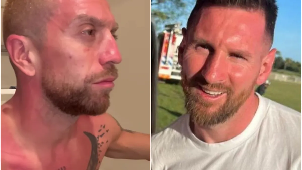 Los jugadores de la Selección Argentina terminaron quemados por el sol: Necesito aloe vera