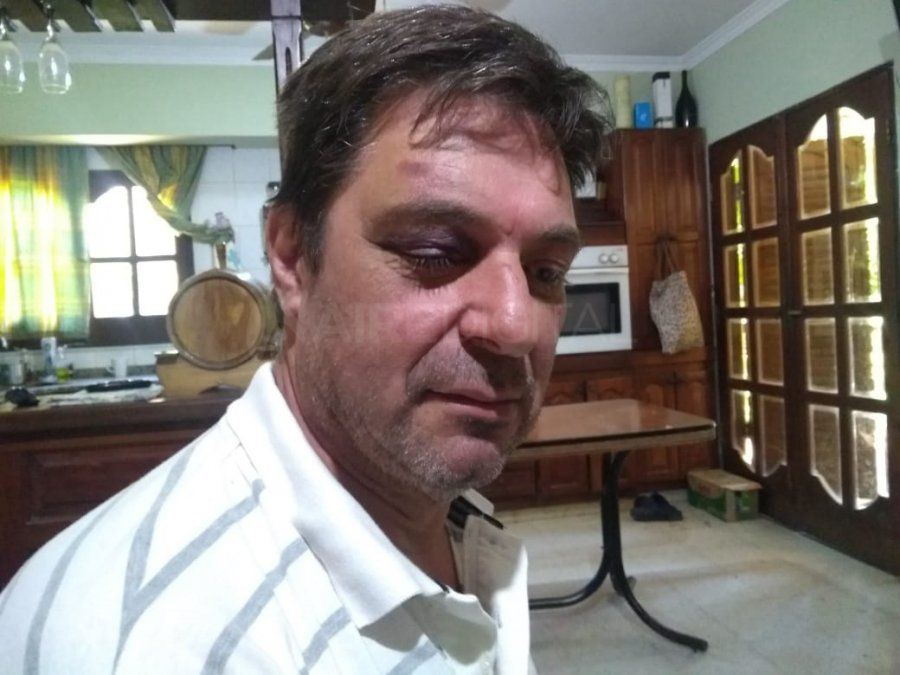 Secuestrado, maniatado y torturado: “Me golpearon con un palo”
