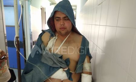 Alexis Lencina es el joven de Coronda accidentado en el vuelco del colectivo en avenida Circunvalación Alexis Lencina es el joven de Coronda accidentado en el vuelco del colectivo en avenida Circunvalación