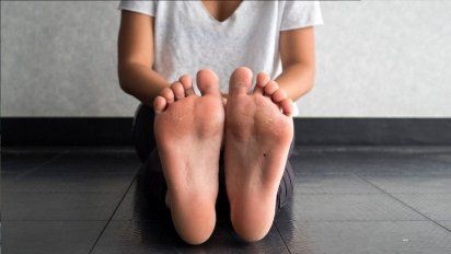 El ingrediente de cocina que deja tus pies suaves y elimina los callos en tiempo récord