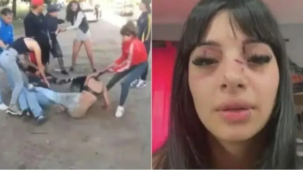 Abril Barrozo fue atacada por cinco mujeres que la insultaron y golpearon luego de divertirse en una reconocida discoteca de zona norte.