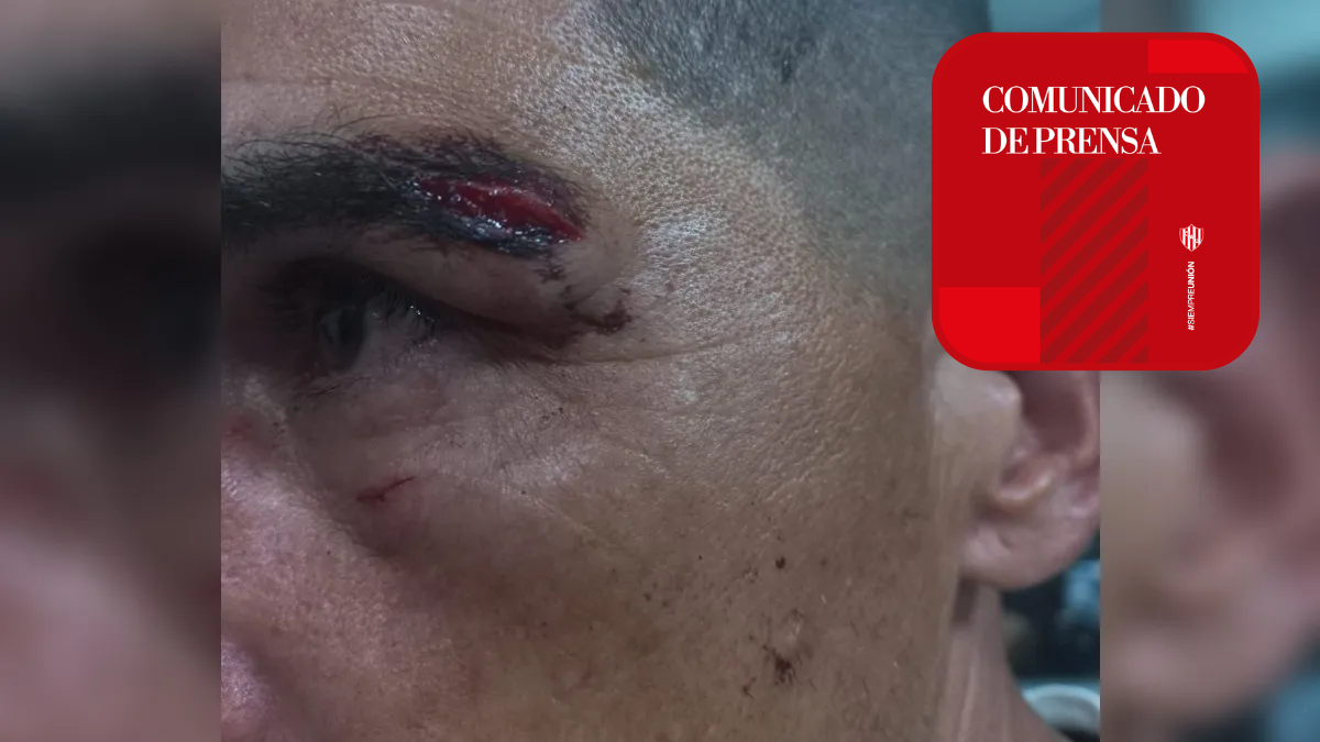 Agredieron al Memo Torres y a su mujer en plena tribuna de Unión: el comunicado del club.