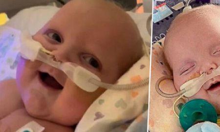 Un bebé sonrió por primera vez luego de ser sometido a dos cirugías a corazón abierto