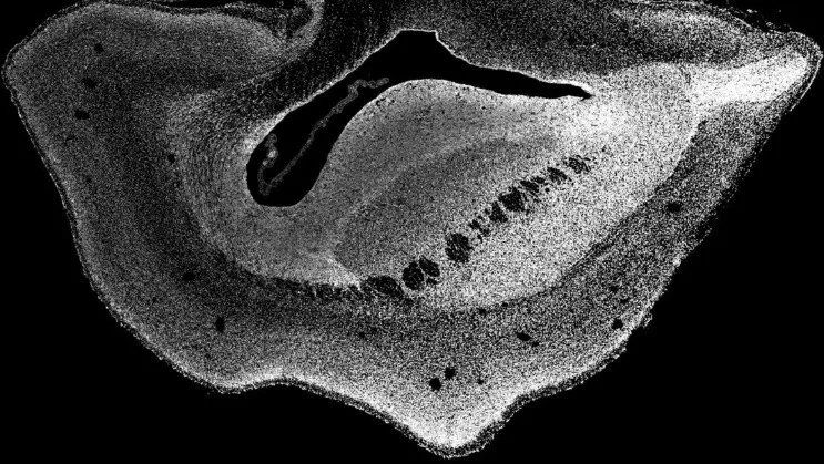 Imagen microscópica de una sección a través de un hemisferio cerebral de un feto de tití modificado de 101 días