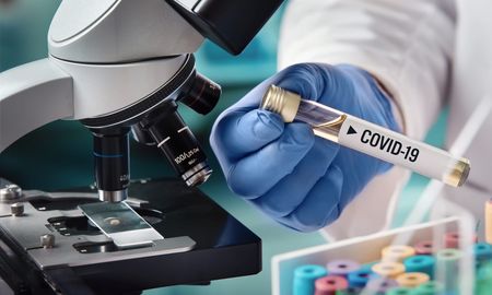 La pandemia coronavirus provoca cientos de miles de decesos en el mundo. La pandemia coronavirus provoca cientos de miles de decesos en el mundo.