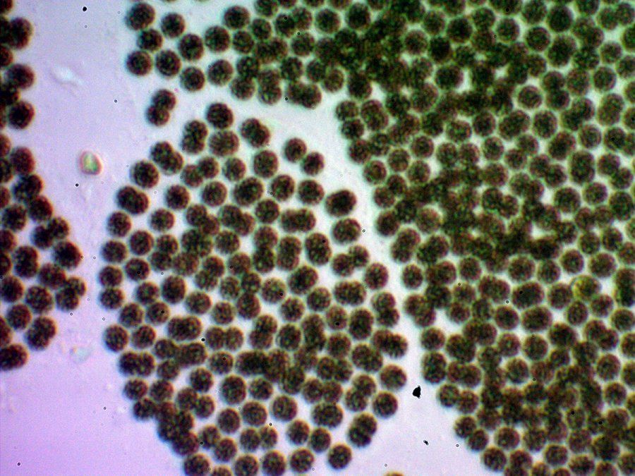 Microcystis aeruginosa, otra de las especies de cianobacteria.
