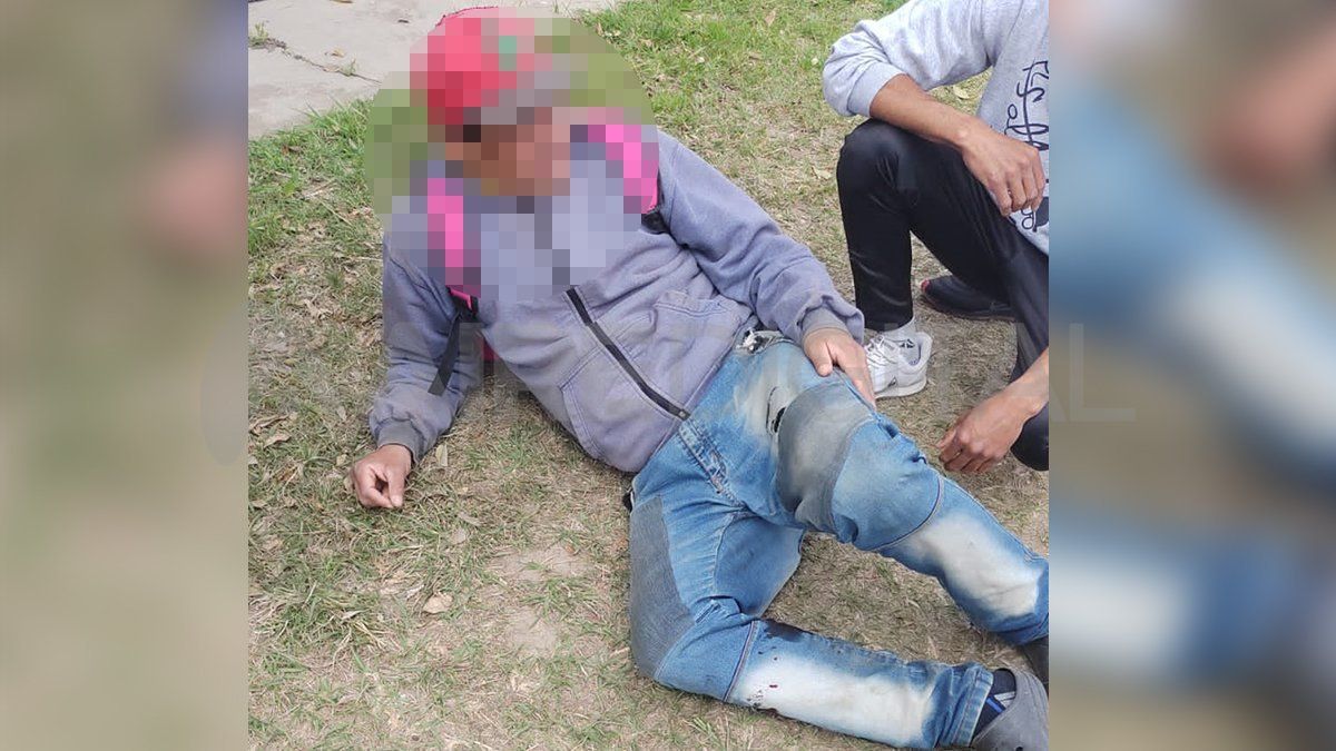 Un hombre de 33 a&ntilde;os fue baleado en la pierna este domingo al mediod&iacute;a en el trueque de Facundo Zuvir&iacute;a.
