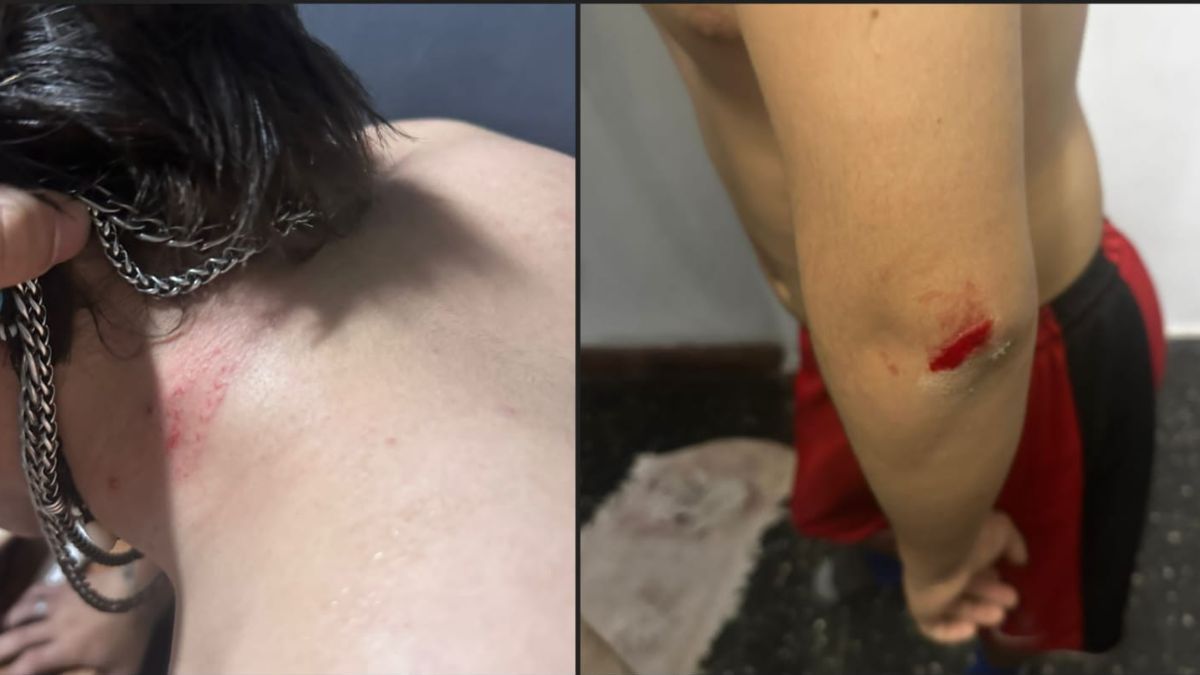 El adolescente recibió asistencia médica y