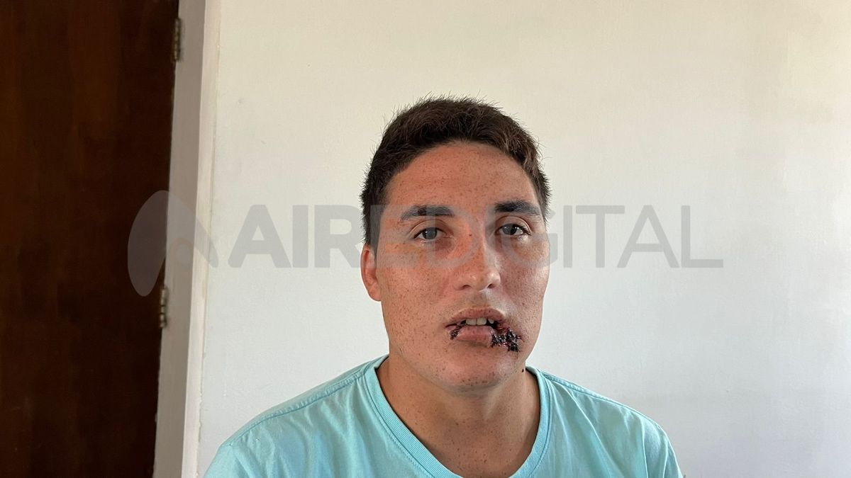 Walter tiene 25 años y fue asaltado brutalmente una semana atrás en Santo Tomé.&nbsp;