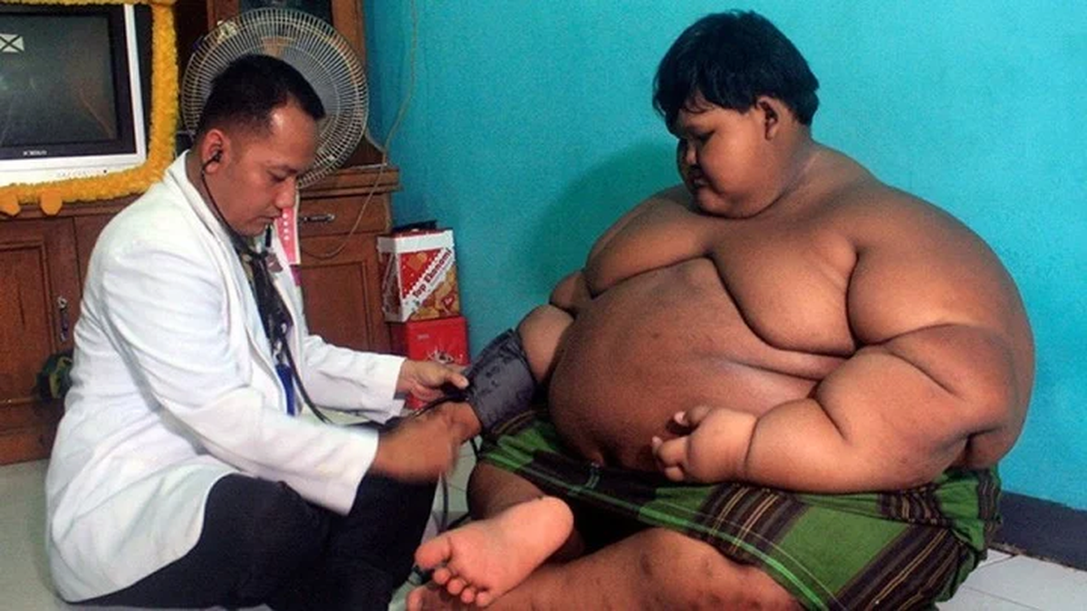 El ni&ntilde;o se someti&oacute; a una estricta dieta y se coloc&oacute; el cintur&oacute;n g&aacute;strico.
