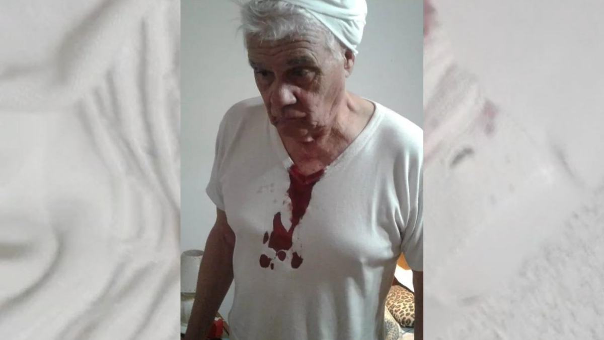 Mario Kovacevich debió ser asistido por los golpes