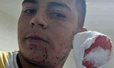 Le cortaron los dedos para robarle: su jefe tomó una drástica decisión Le cortaron los dedos para robarle: su jefe tomó una drástica decisión