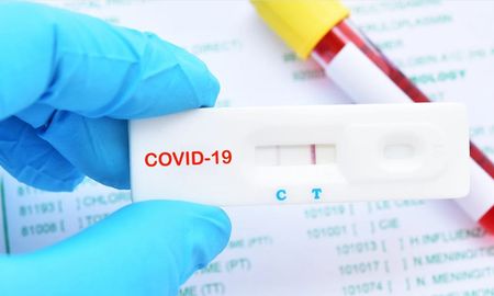 Los test rápidos se pueden comprar en las farmacias y deben ser llevador a un profesional para que los realice. Los test rápidos se pueden comprar en las farmacias y deben ser llevador a un profesional para que los realice.