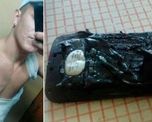 le exploto el celular mientras dormia y sufrio quemaduras en su cuerpo le exploto el celular mientras dormia y sufrio quemaduras en su cuerpo
