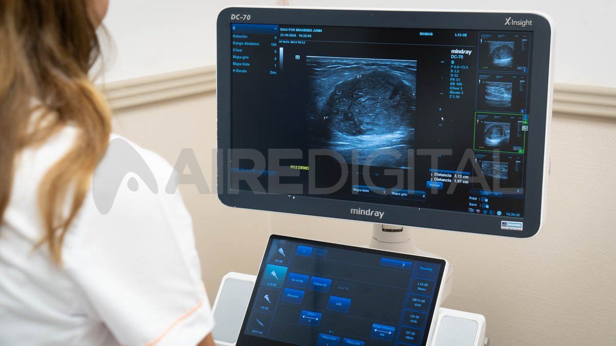El diagnóstico por imágenes es ideal para realizar diagnósticos.&nbsp;