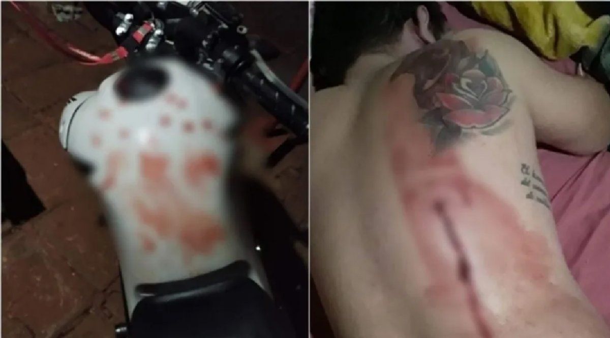 Hacían ruido con el escape de una moto y un vecino los corrió a tiros