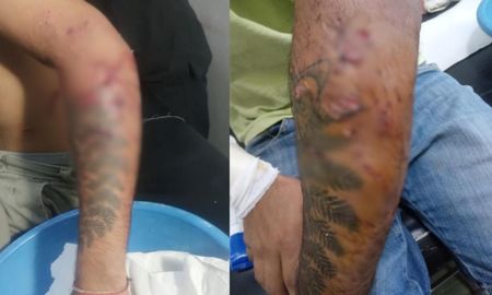 Un joven de 19 años fue atacado por tres perros cuando volvía de trabajar Un joven de 19 años fue atacado por tres perros cuando volvía de trabajar