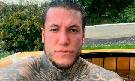 Alex Caniggia decidió someterse a un importante procedimiento estético. Alex Caniggia decidió someterse a un importante procedimiento estético.