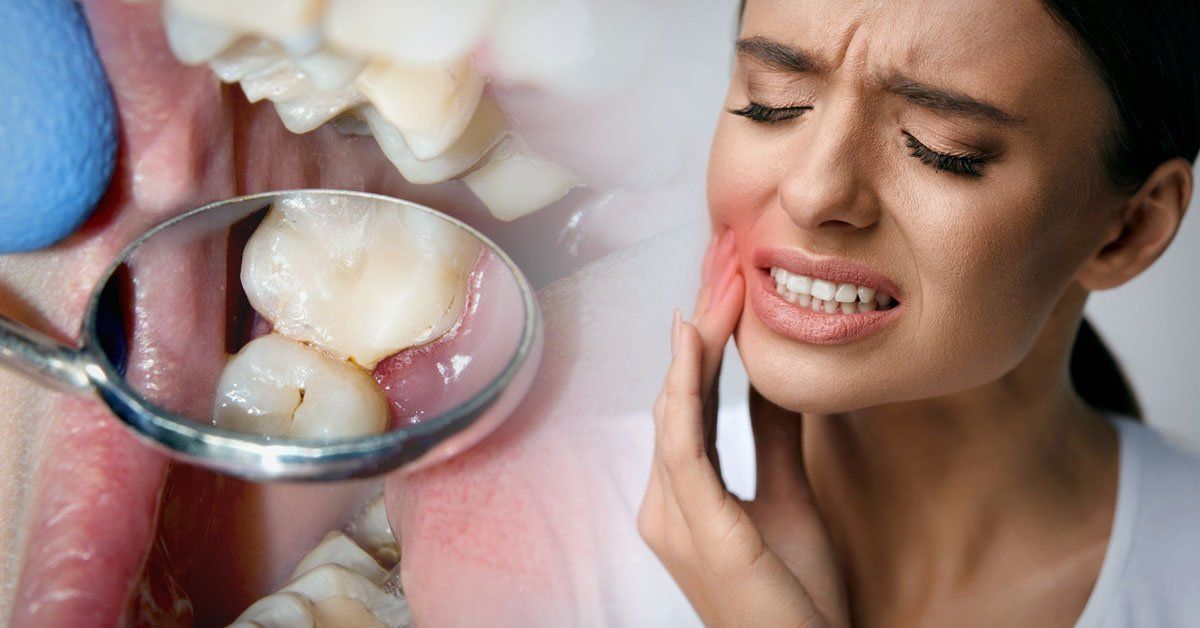 Estas pueden ser las causas de las caries en adultos