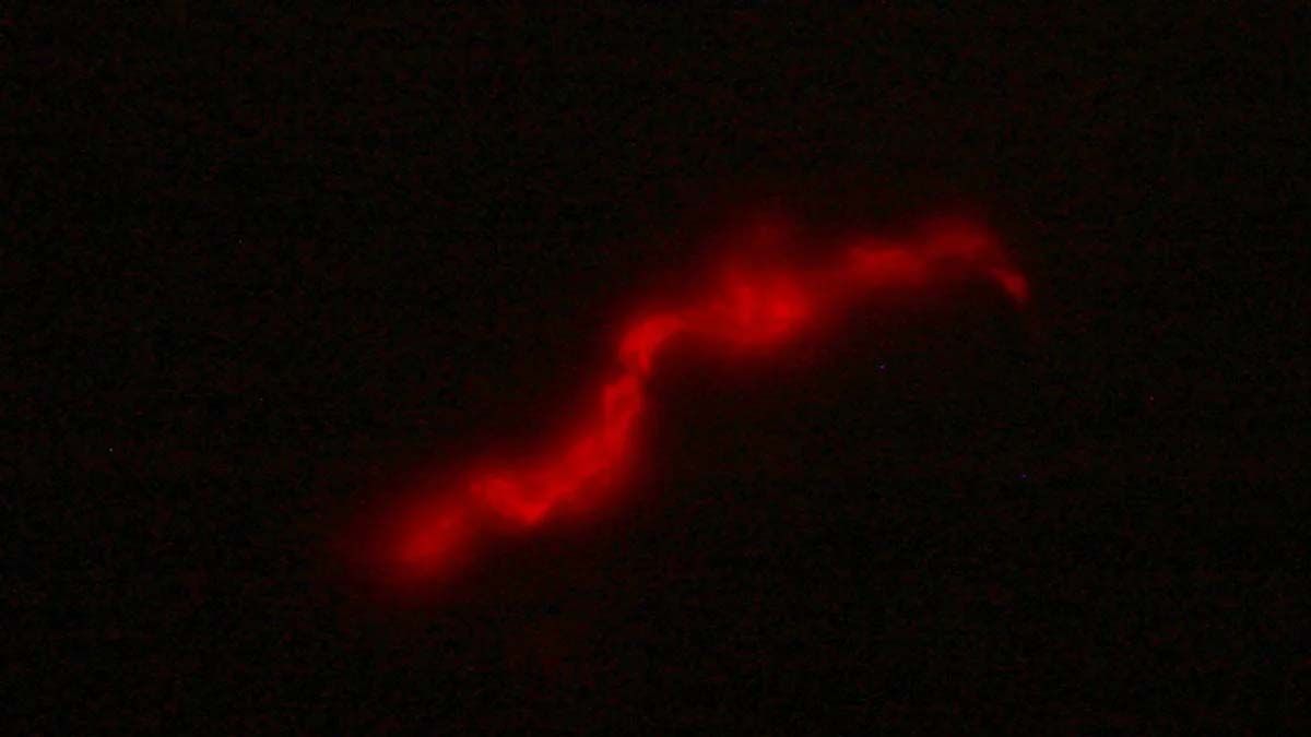 Científicos del CONICET desarrollaron un test rápido y de bajo costo para el diagnóstico de la tuberculosis.