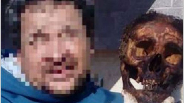Se sacó una foto con un cráneo en el cementerio de Sunchales