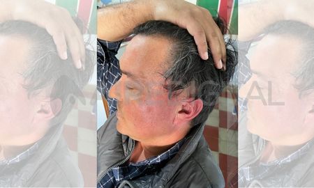 El productor agropecuario agredido por el presidente comunal de Villa Saralegui El productor agropecuario agredido por el presidente comunal de Villa Saralegui