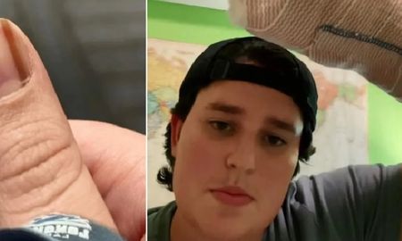 Viral: vivió 10 años con una extraña mancha en la uña y quedó devastada al descubrir lo que realmente era Viral: vivió 10 años con una extraña mancha en la uña y quedó devastada al descubrir lo que realmente era