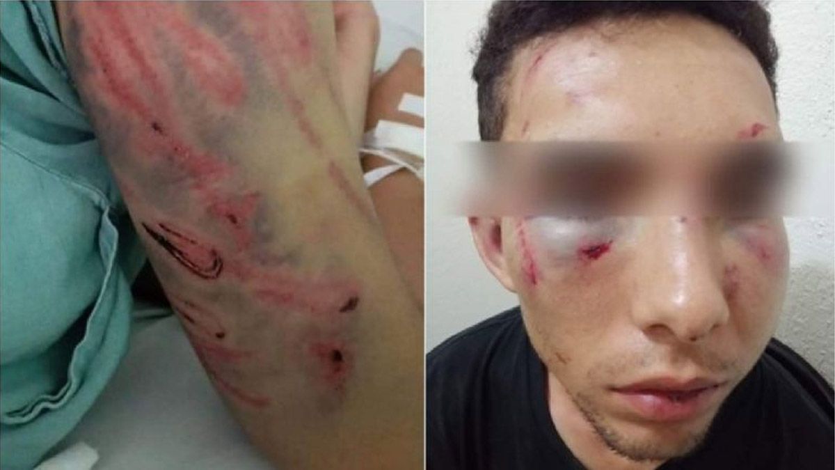 Imágenes de Carlos Armando, primo de Remmy Valenzuela que se viralizaron en redes sociales tras la golpiza.