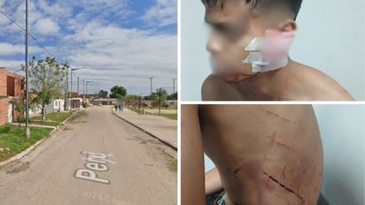Batalla campal en Barrio Barranquitas: tres heridos tras una pelea con botellas de vidrio y golpes
