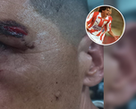 Agredieron al Memo Torres y a su mujer en plena tribuna de Unión: Me hicieron 3 puntos. Agredieron al Memo Torres y a su mujer en plena tribuna de Unión: Me hicieron 3 puntos.