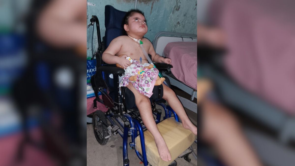 Brenda tiene cinco años y sufre síndrome de Wolf