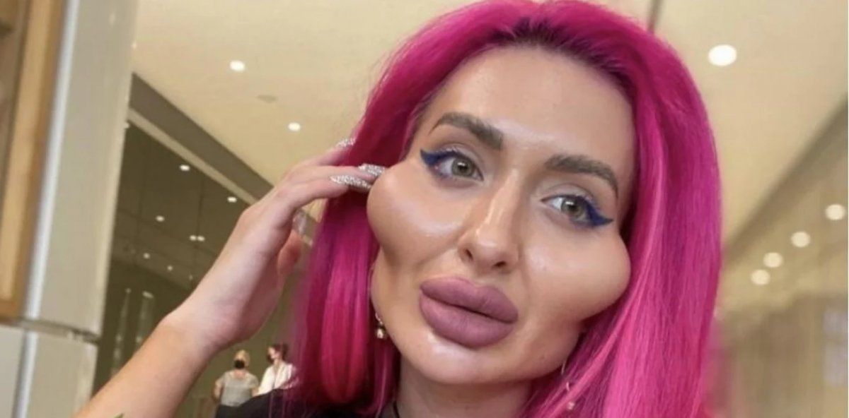 Anastasia Pokreshchuk perdió la cuenta de las infiltraciones que se hizo.