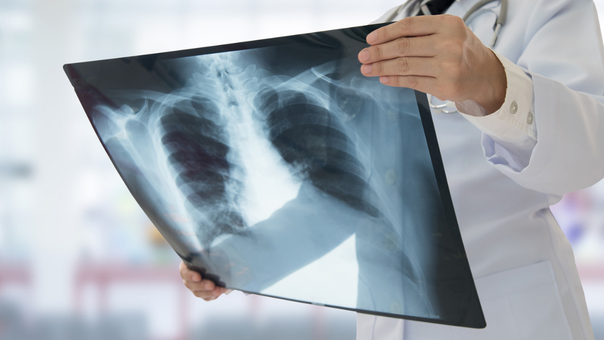 Los alumnos también deberán realizarse una radiografía.