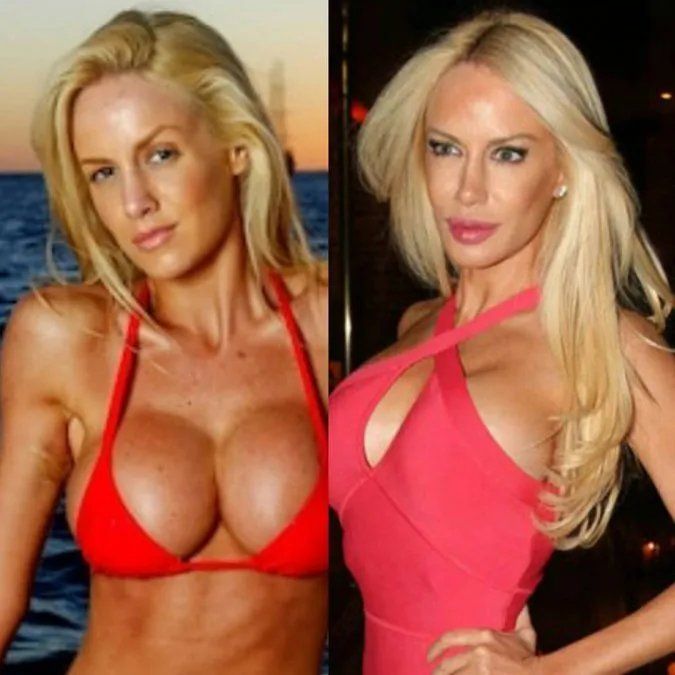 El antes y después de Luciana Salazar.