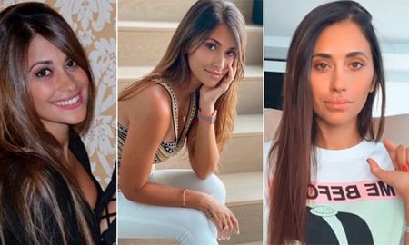 Los usuarios aseguran que Antonela Roccuzzo se inyectó ácido hialurónico. Los usuarios aseguran que Antonela Roccuzzo se inyectó ácido hialurónico.