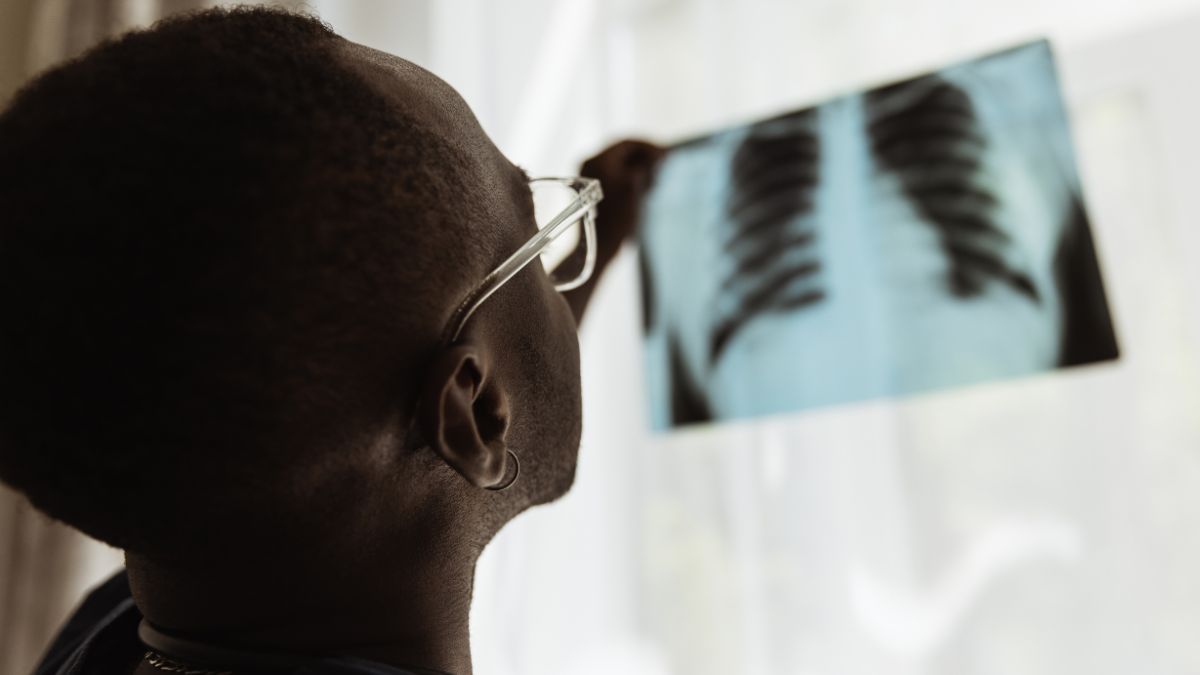 Cada 24 de marzo se conmemora el Día Mundial de la Tuberculosis