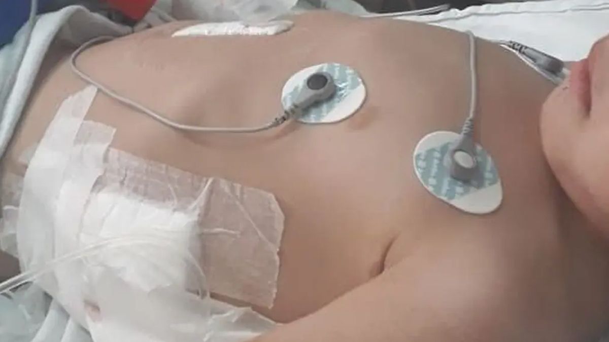 Un niño de 3 años fue atacado ferozmente por un dogo y dos pitbull