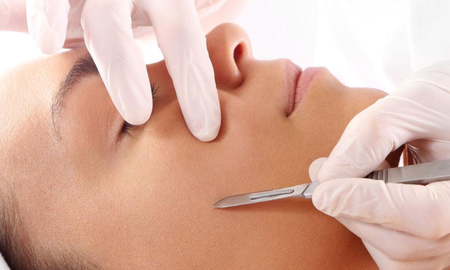 Los beneficios y riesgos del Dermaplaning, la última tendencia en belleza que triunfa en TikTok Los beneficios y riesgos del Dermaplaning, la última tendencia en belleza que triunfa en TikTok
