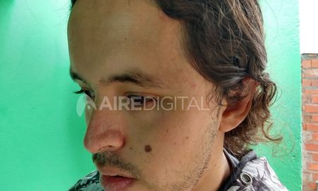 Recibió el golpe en la zona de la sien. Recibió el golpe en la zona de la sien.