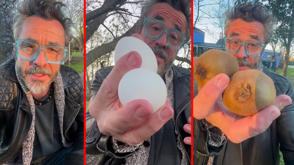 Pablo Granados se hizo la vasectomía y explicó el procedimiento con un video