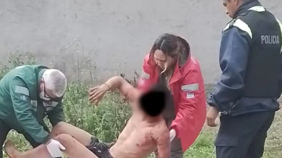 Hombre de 28 años en estado crítico tras ataque de jauría de perros en Yerba Buena. Hombre de 28 años en estado crítico tras ataque de jauría de perros en Yerba Buena.