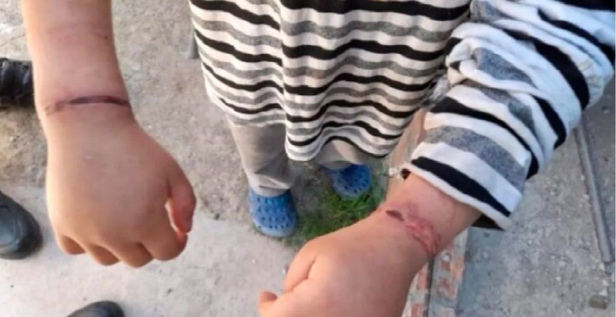 Rescataron a un nene de 6 años que había sido atado con alambres por su madre en Moreno