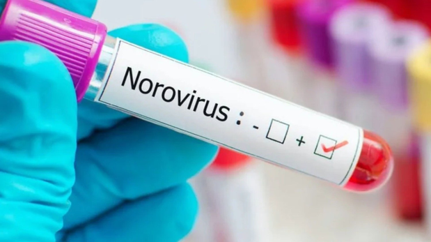 Qué es el norovirus, la enfermedad que afectó a 180 estudiantes en Bariloche