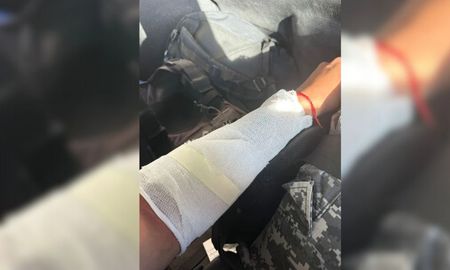 Al arribar al lugar, el agresor arrojó un balde con agua caliente hacia los policías, provocándole lesiones. Al arribar al lugar, el agresor arrojó un balde con agua caliente hacia los policías, provocándole lesiones.