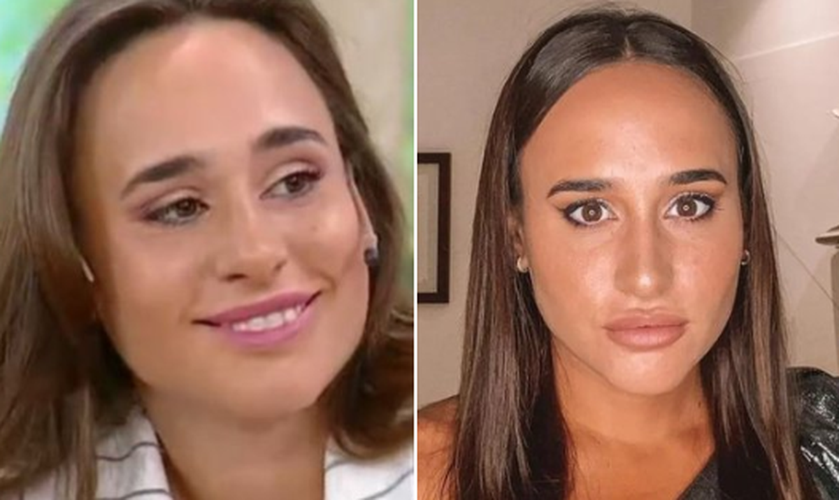 El increíble cambio de Martina Stewart de Gran Hermano luego de pasar por el quirófano