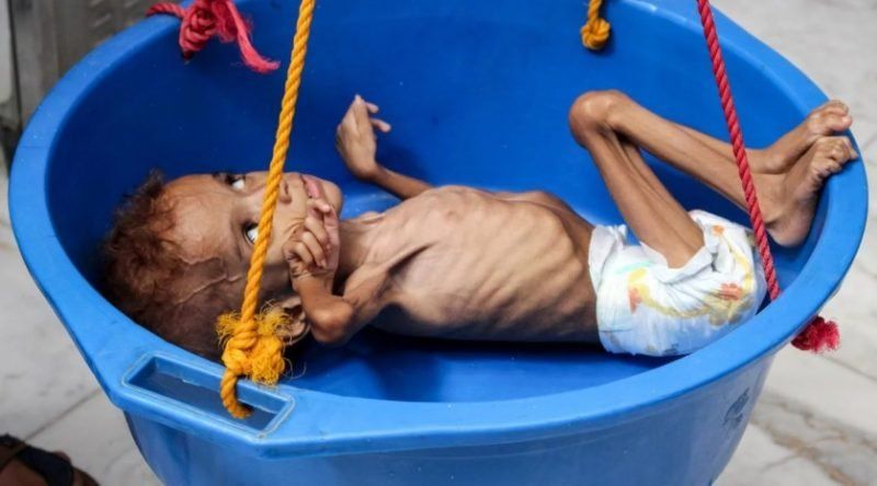 La ONU advierte que la guerra civil en Yemen será el peor desastre humanitario